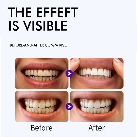 QimGo Whitening Strips box dimensions – 42 strips