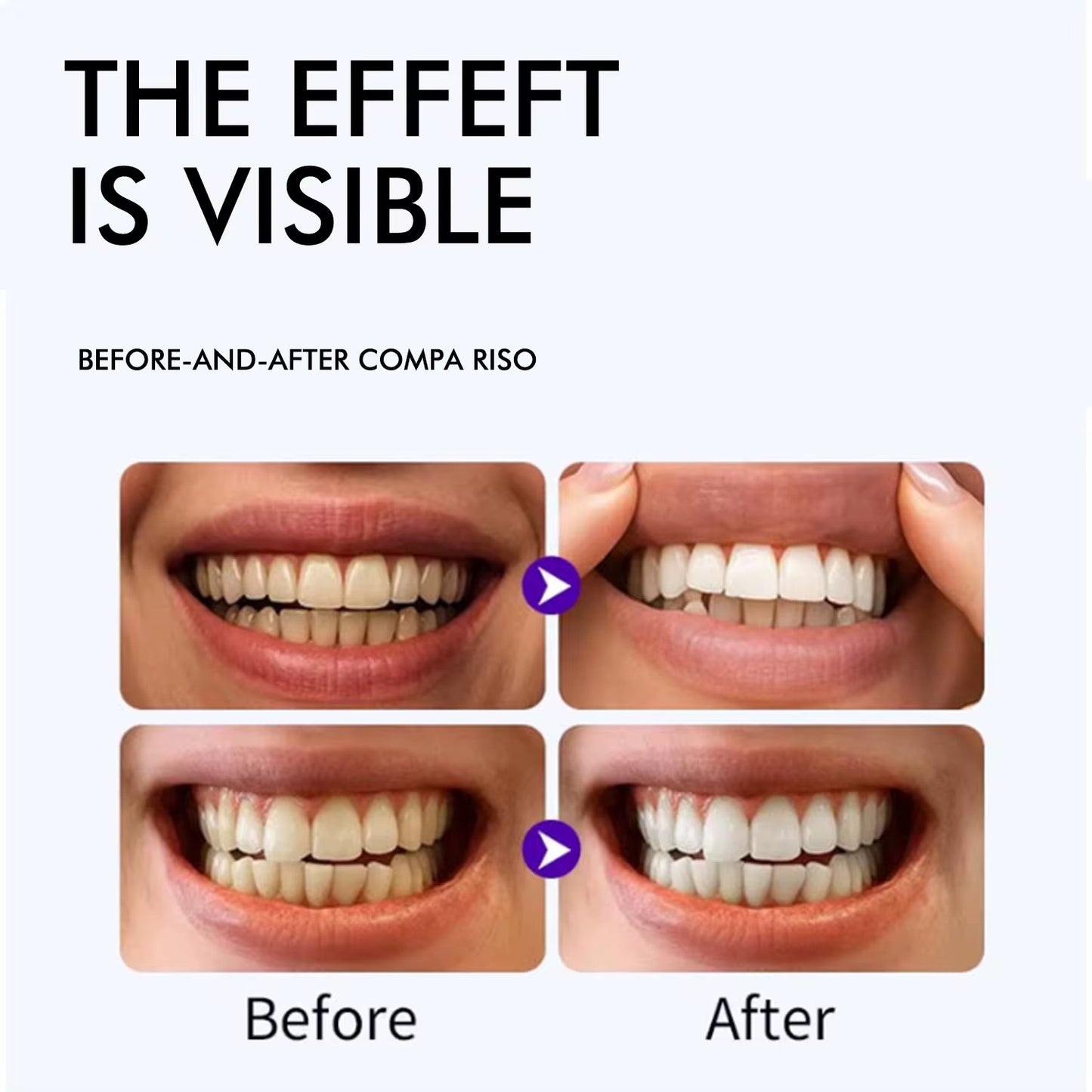 QimGo Whitening Strips box dimensions – 42 strips